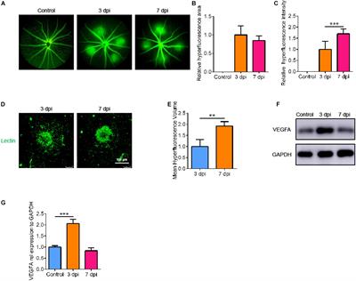 SLC7A11 Reduces Laser-Induced Choroidal Neovascularization by Inhibiting RPE Ferroptosis and VEGF Production